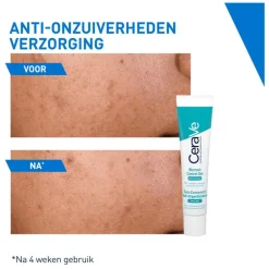 CeraVe Anti-Onzuiverheden Verzorging 40 ML