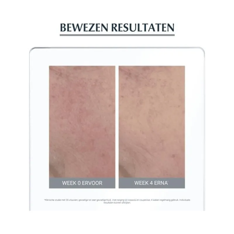 Eucerin AntiREDNESS Kalmerende Crème 50 ML