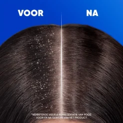 Head and Shoulders Head & Shoulders Citrus Fresh Anti-Roos Shampoo 300 ML
