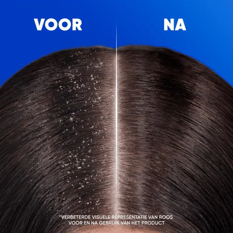 Head and Shoulders Head & Shoulders Jeukende Hoofdhuid Anti-Roos Shampoo 300 ML