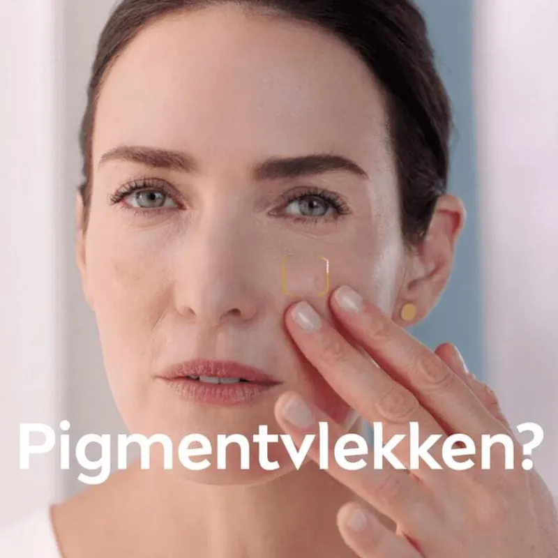 NIVEA Luminous630 Post-Acne Vlekken Serum 30 ML