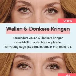 Remescar Wallen & Donkere Kringen Crème 8 ML
