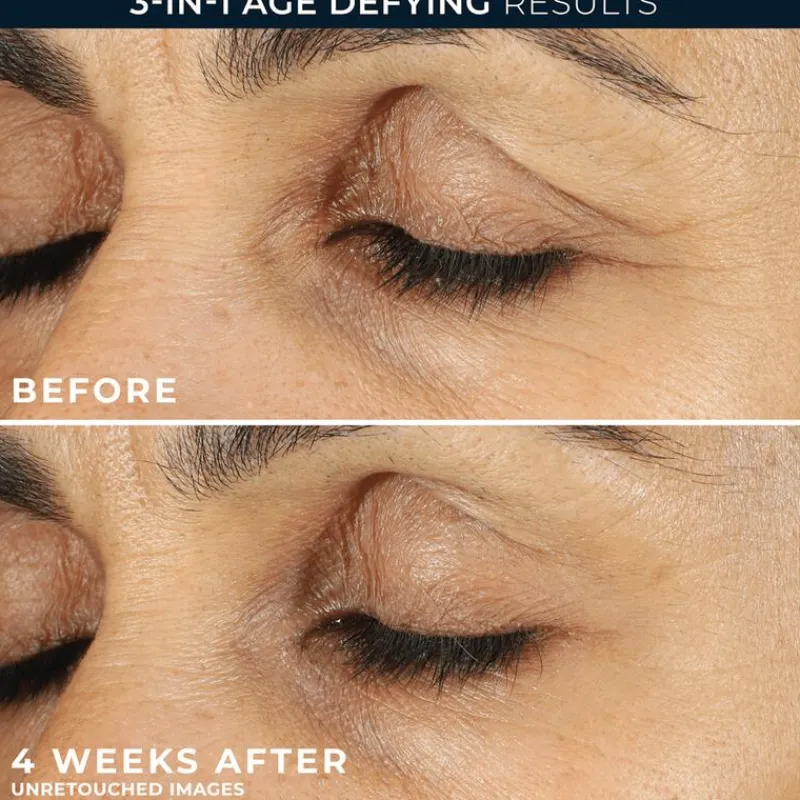 RoC Retinol Correxion Line Smoothing Eye Cream 15 ML