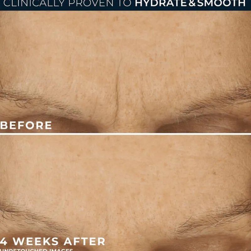 RoC Retinol Correxion Line Smoothing Max Hydration 50 ML