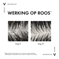 Vichy Dercos Anti-Roos Shampoo Droog Haar 390 ML