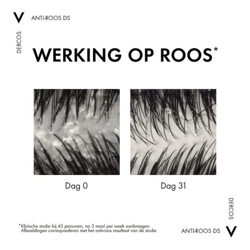 Vichy Dercos Anti-Roos Shampoo Droog Haar 390 ML