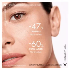 Vichy Liftactiv Supreme H.A. Epidermic Filler Serum 30 ML